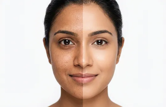 Anti-Pigmentation & Sun Tan Removal