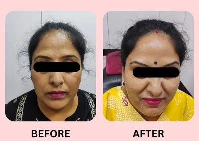 Skin Treatment Case 3