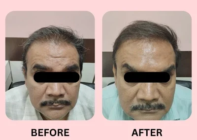 Skin Treatment Case 6