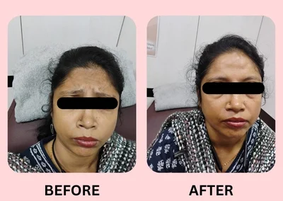 Skin Treatment Case 4
