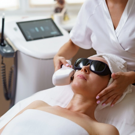 CO2 Laser Treatment
