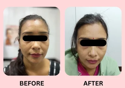 Skin Treatment Case 1