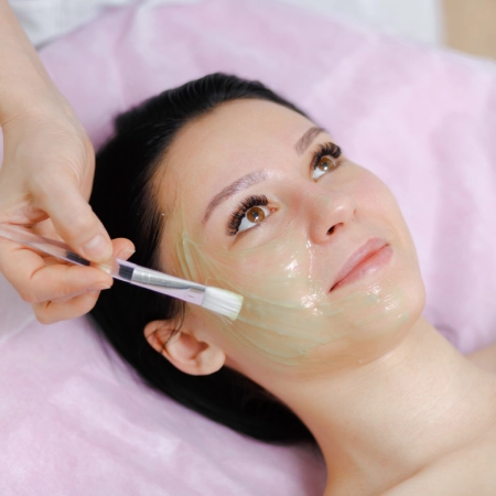 Chemical Peel