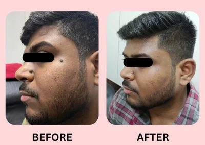 Skin Treatment Case 2