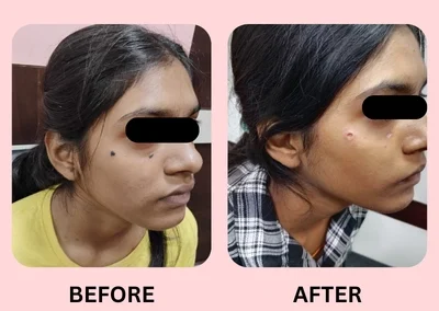 Skin Treatment Case 5