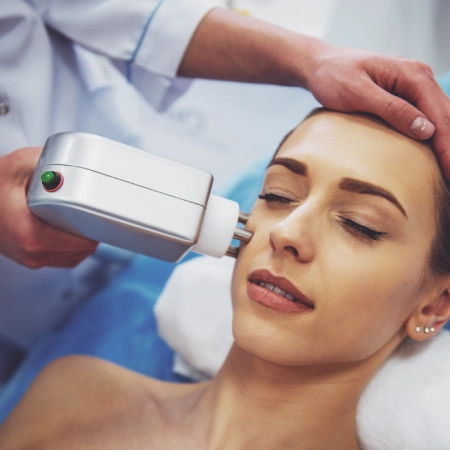 Morpheus Laser Treatment